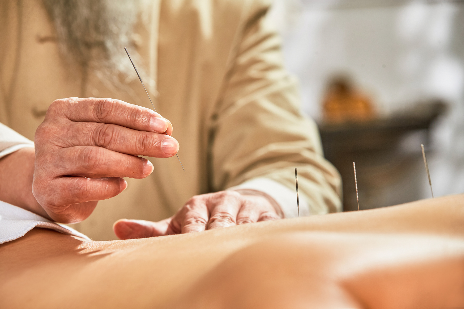 Traditional Chinese Medicine 